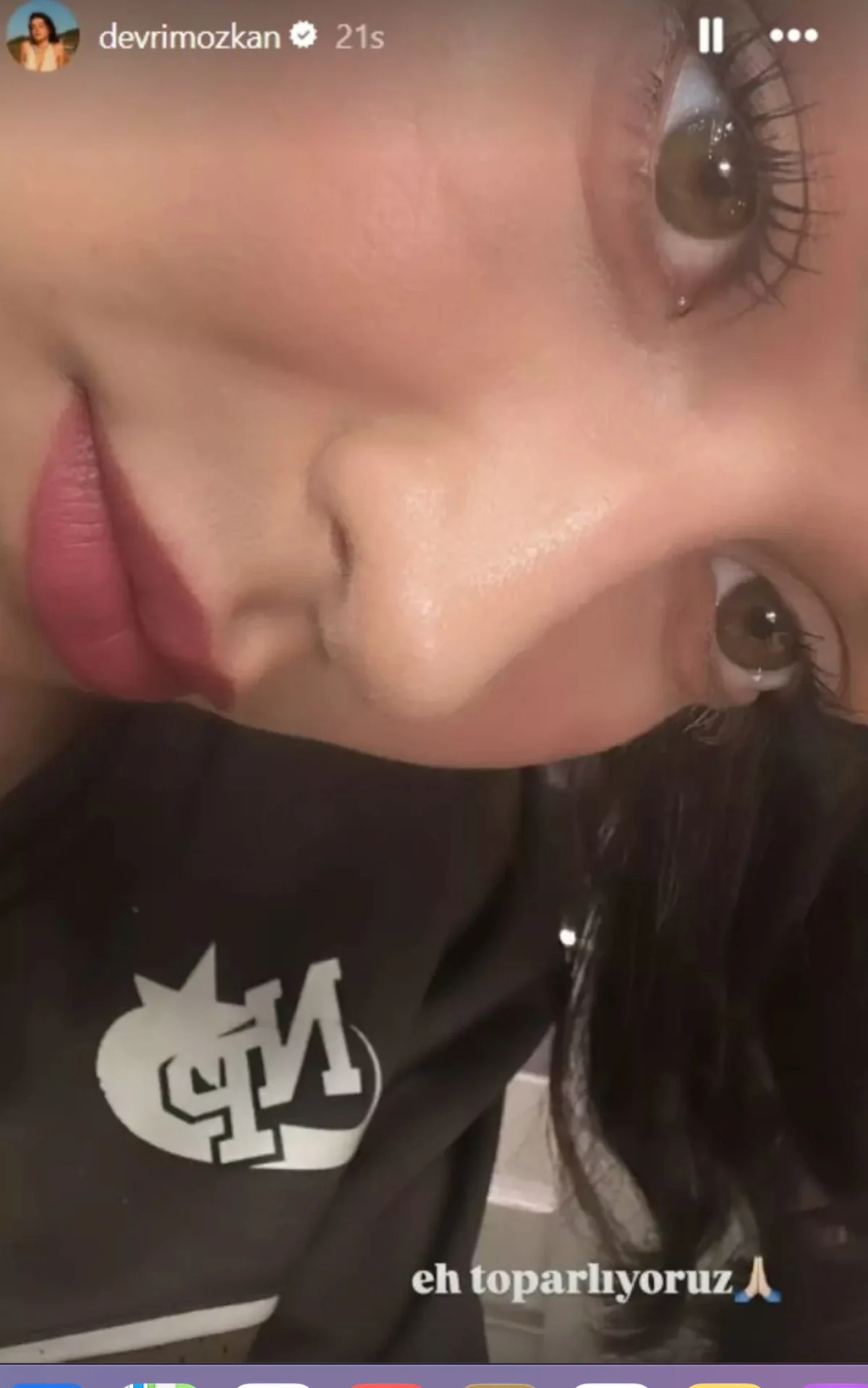 Ameliyat Geçiren Devrim Özkan’dan Sağlık Açıklaması